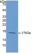 LAMA1 / Laminin Alpha 1 Antibody (aa1156-1276)