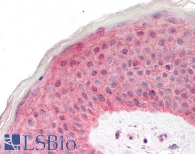 IHC-plus™ Polyclonal Rabbit anti-Human GPC1 / Glypican Antibody (IHC, IF)