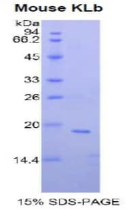 Mouse KLB / Beta Klotho Protein (Recombinant His)