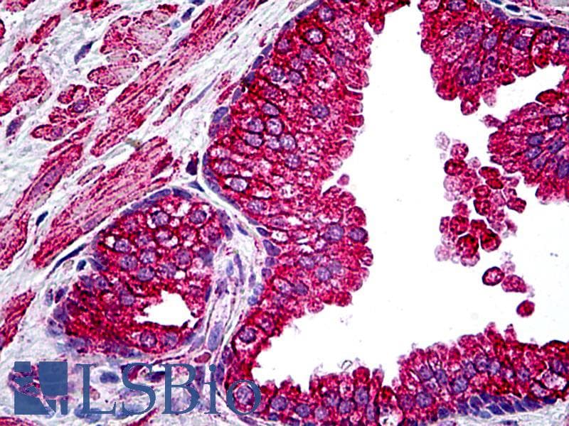 PathPlus™ CFTR Antibody (aa2-14)