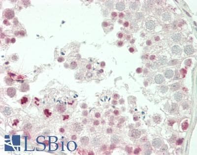 IHC-plus™ PMP70 Antibody (N-Terminus)