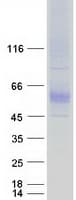 Human SLC7A4 Protein (Recombinant Myc-DDK (Flag))