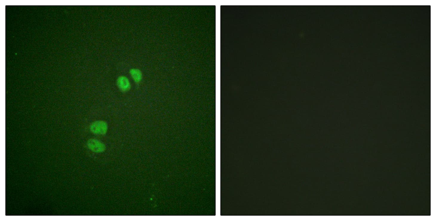 PLK1 / PLK-1 Antibody (aa176-225)