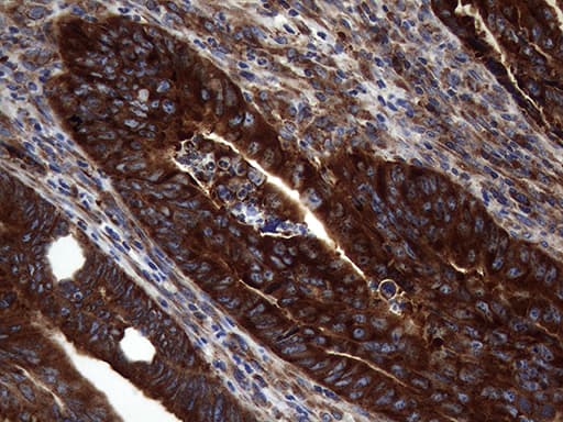 Monoclonal Mouse anti-Human DIRAS2 Antibody (clone OTI8A5, aa1-196, IHC, WB)