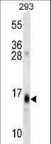 RGS8 Antibody (aa14-43)