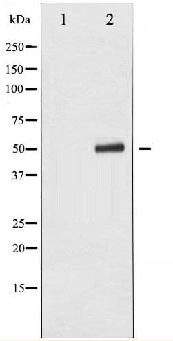TP53 / p53 Antibody (phospho-Ser9)