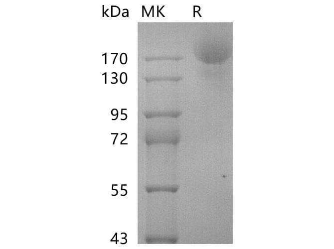 Coronavirus SARS-CoV-2 SARS-CoV-2 Spike Glycoprotein (Recombinant 6His, C-terminus)