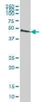 IHC-plus™ SMAD2 Antibody (clone 3G6)