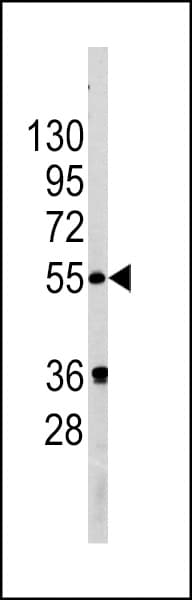 Polyclonal Rabbit anti-Human GOPC / PIST Antibody (aa164-193, IHC, WB)