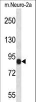 CHSY1 Antibody (aa504-533)