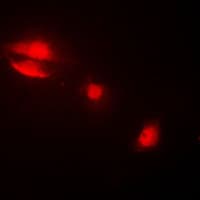 KRT14 / CK14 / Cytokeratin 14 Antibody (N-Terminus)