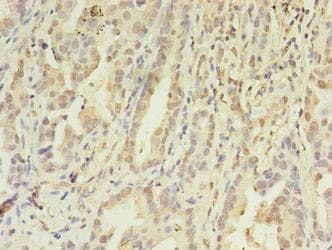 FGL2 Antibody (aa24-439)