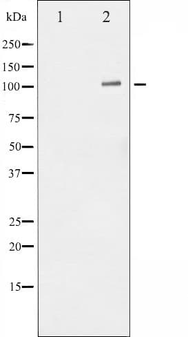 NFKB1 / NF-Kappa-B Antibody (phospho-Ser932)