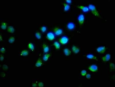 FGF1 / Acidic FGF Antibody (aa16-155)