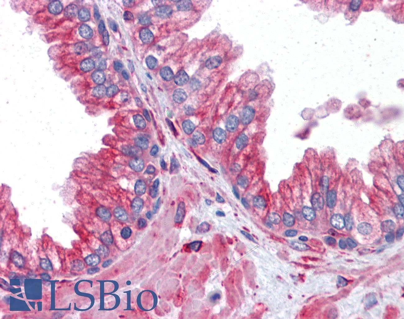 IHC-plus™ Monoclonal Mouse anti-Human TUBA4A / TUBA1 Antibody (clone 2E11, IHC, IF, WB)