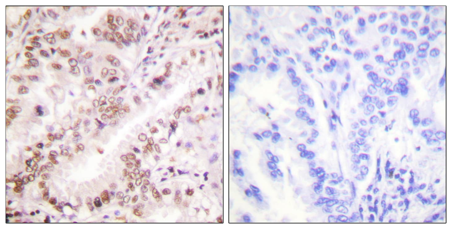 Polyclonal Rabbit anti-Human ER Alpha / Estrogen Receptor Antibody (phospho-Tyr537, IHC, WB)