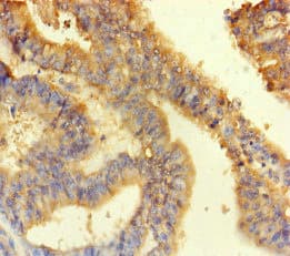 Polyclonal Rabbit anti-Human ANKS6 Antibody (IHC, IF)