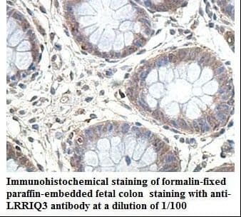 Polyclonal Rabbit anti-Human LRRIQ3 Antibody (aa29-190, IHC, WB)