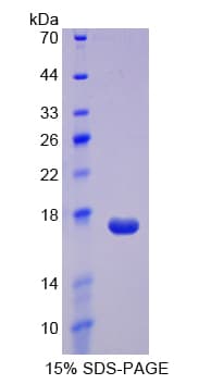 Rat REG3A Protein (Recombinant His-T7)