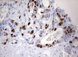 Monoclonal Mouse anti-Human MKI67 / Ki67 Antibody (clone OTI14G1, aa1160-1493, IHC)