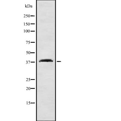 SLC9A3R1 / NHERF1 / EBP50 Antibody