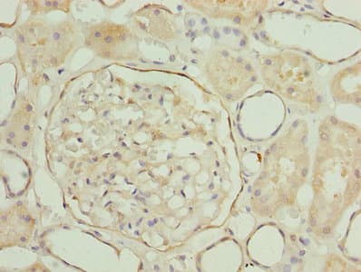 LRRN2 / GAC1 Antibody