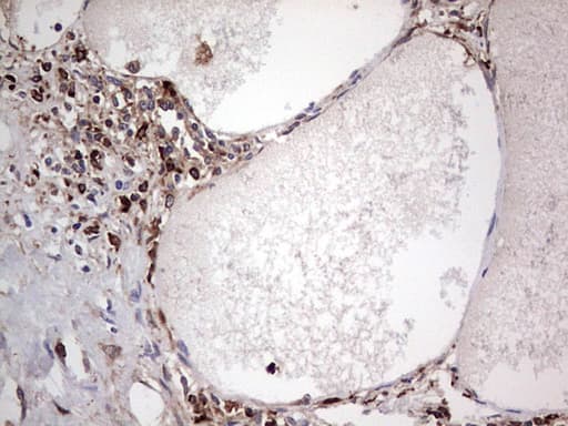 PKM2 Antibody (clone 12B9)