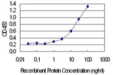 CALB1 / Calbindin Antibody (clone 1F6)