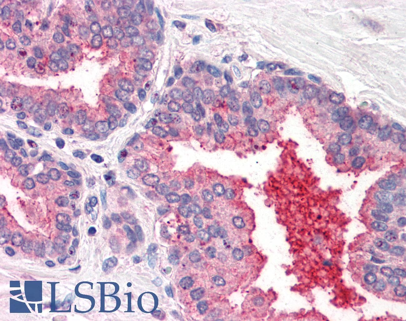 IHC-plus™ DPP4 / CD26 Antibody (N-Terminus)
