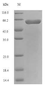 Escherichia coli fadL Protein (Recombinant 6His-SUMO, N-terminus)