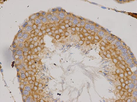 IKBKG / NEMO / IKK Gamma Antibody