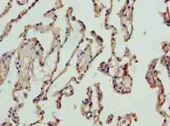 Polyclonal Rabbit anti-Human NICN1 Antibody (IHC, WB)
