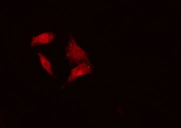Polyclonal Rabbit anti-Human BCCIP Antibody (IF, WB)