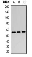 PPARG / PPAR Gamma Antibody (Internal)