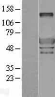Human Peripherin Protein (Over-Expression Lysate Myc-DDK (Flag))