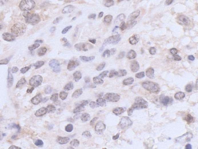 Polyclonal Rabbit anti-Human UBR5 Antibody (aa600-650, IHC, WB)