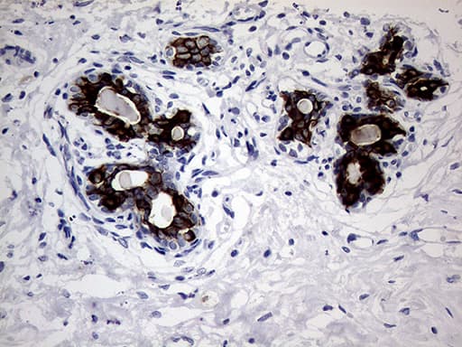 KRT18 / CK18 / Cytokeratin 18 Antibody (aa69-372, clone OTI10H8)