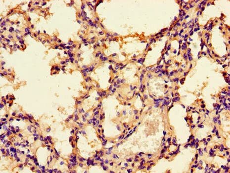 PRKAA1 / AMPK Alpha 1 Antibody