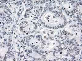 CRYAB / Alpha B Crystallin Antibody (clone OTI6G5)