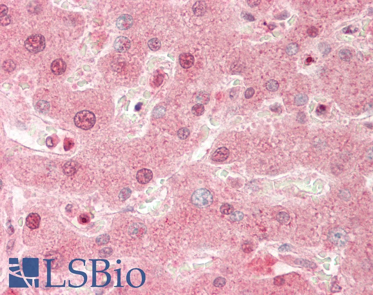 Polyclonal Rabbit anti-Human PREP / Prolyl Endopeptidase Antibody (C-Terminus, IHC, WB)