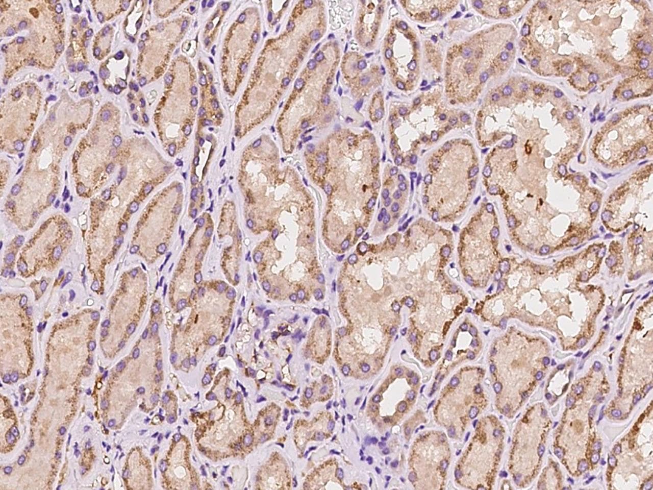 PIP5K1B Antibody