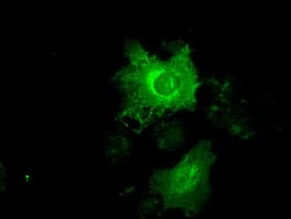 PathPlus™ Monoclonal Mouse anti-Human KRT19 / CK19 / Cytokeratin 19 Antibody (clone 3F8, IHC, IF, WB)