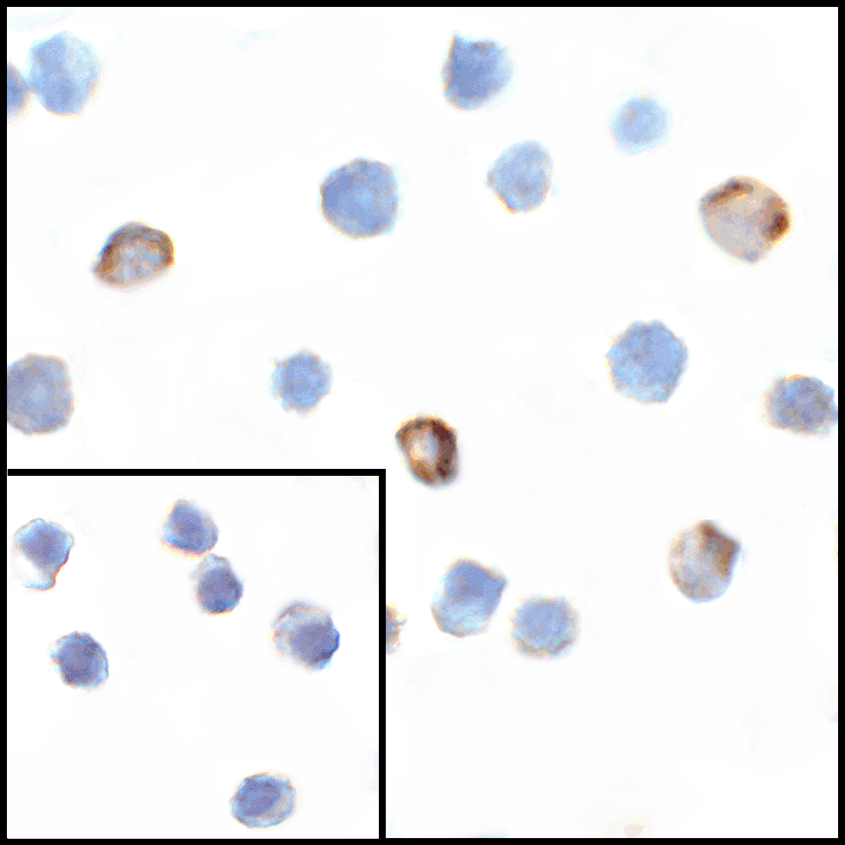 Polyclonal Rabbit anti-Human VSIR / GI24 / VISTA Antibody (IHC, IF, WB)
