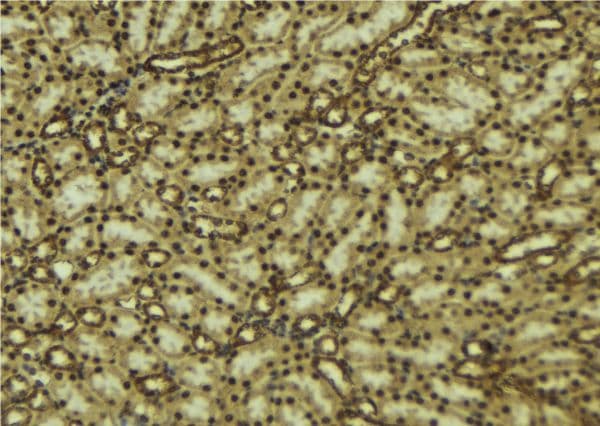 MAPK7 / ERK5 Antibody
