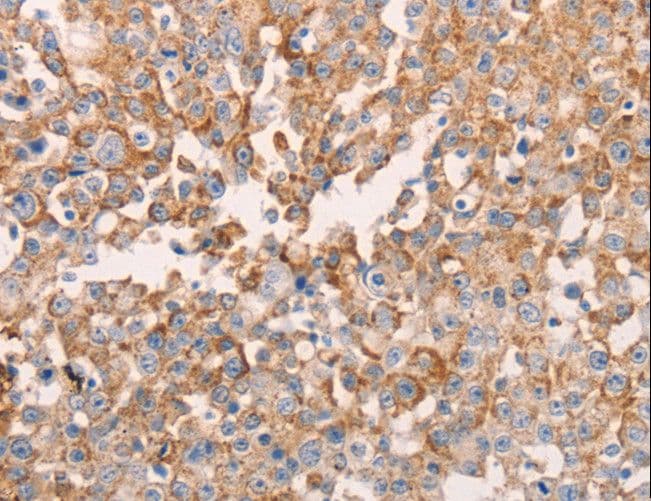 GNA11 Antibody