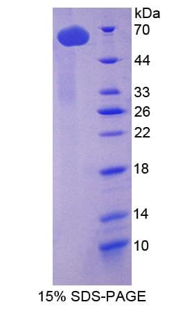 Human TUBD1 / Tubulin Delta Protein (Recombinant His-GST)