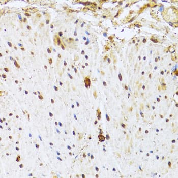 Polyclonal Rabbit anti-Human CDK4 Antibody (IHC, IF, WB)