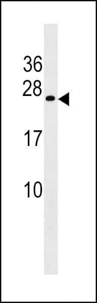 EMC8 / COX4NB Antibody (aa78-106)