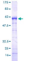 Human SPT3 / SUPT3H Protein (Recombinant GST)