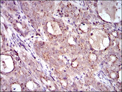 Monoclonal Mouse anti-Human MRPL42 / MRPS32 Antibody (clone 3H6G11, aa142-203, IHC, IF, WB)